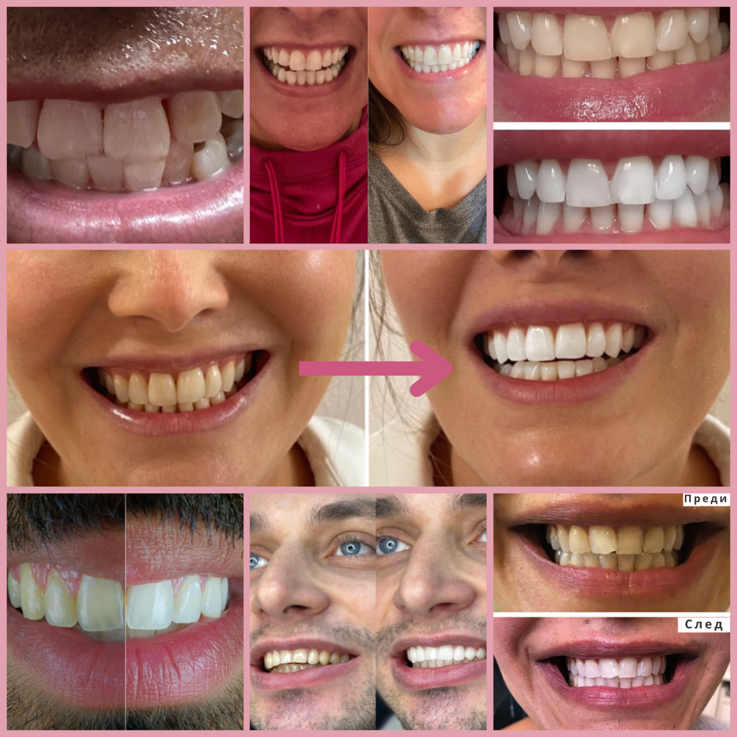 BodyAccel Натурална избелваща паста – Нежна формула с ниацинамид